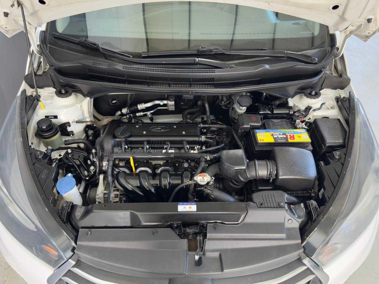 HB20 SEDAN 1.6 AT